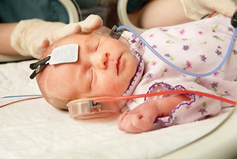 Sleep Apnea: Understanding the Silent Nighttime Threat