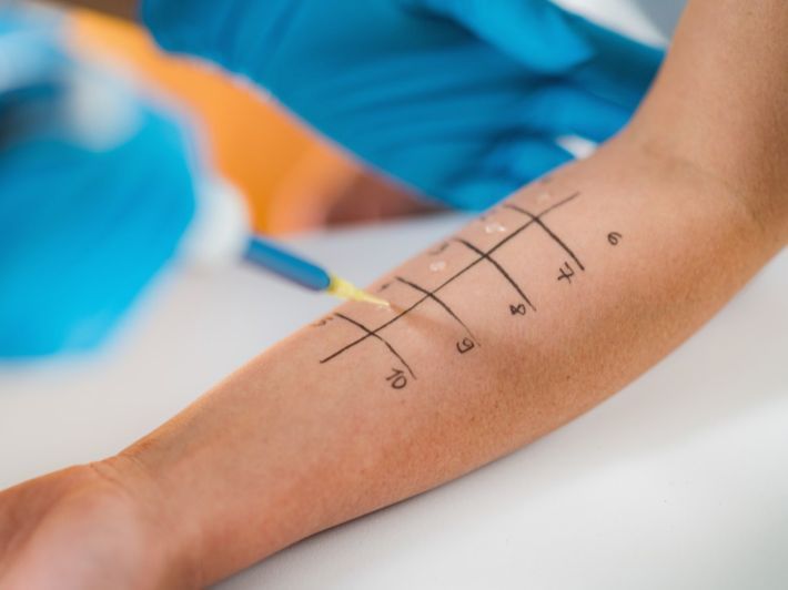 اختبار الحساسيه