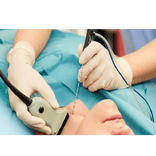 ENT tumor biopsy procedure for tissue sampling and diagnosis.png
