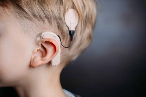 Understanding Cochlear Implantation: A Life-Changing Solution for Hearing Loss