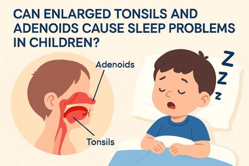 When Does a Child Need Adenoid Surgery?