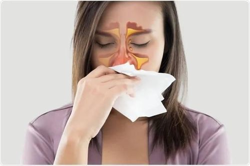 Does Nasal Allergy Cause Persistent Nasal Congestion?